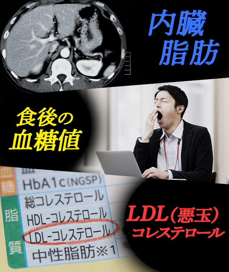 高いBMI、血糖値、LDLコレステロール